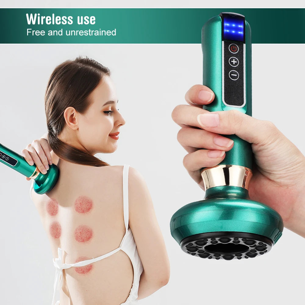 Flozen® Electric Cupping &amp; Gua Sha Massager — 12-Level Heat, One-Touch Release